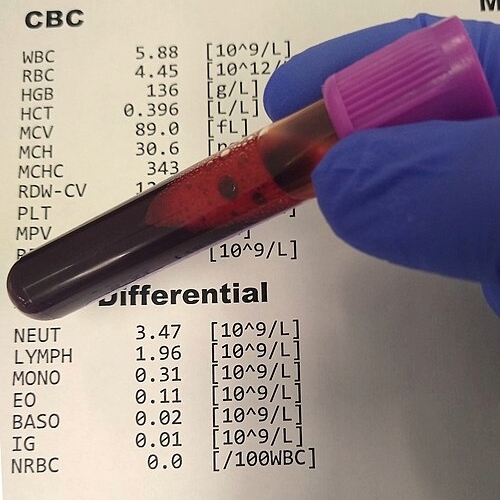 The Complete Blood Count